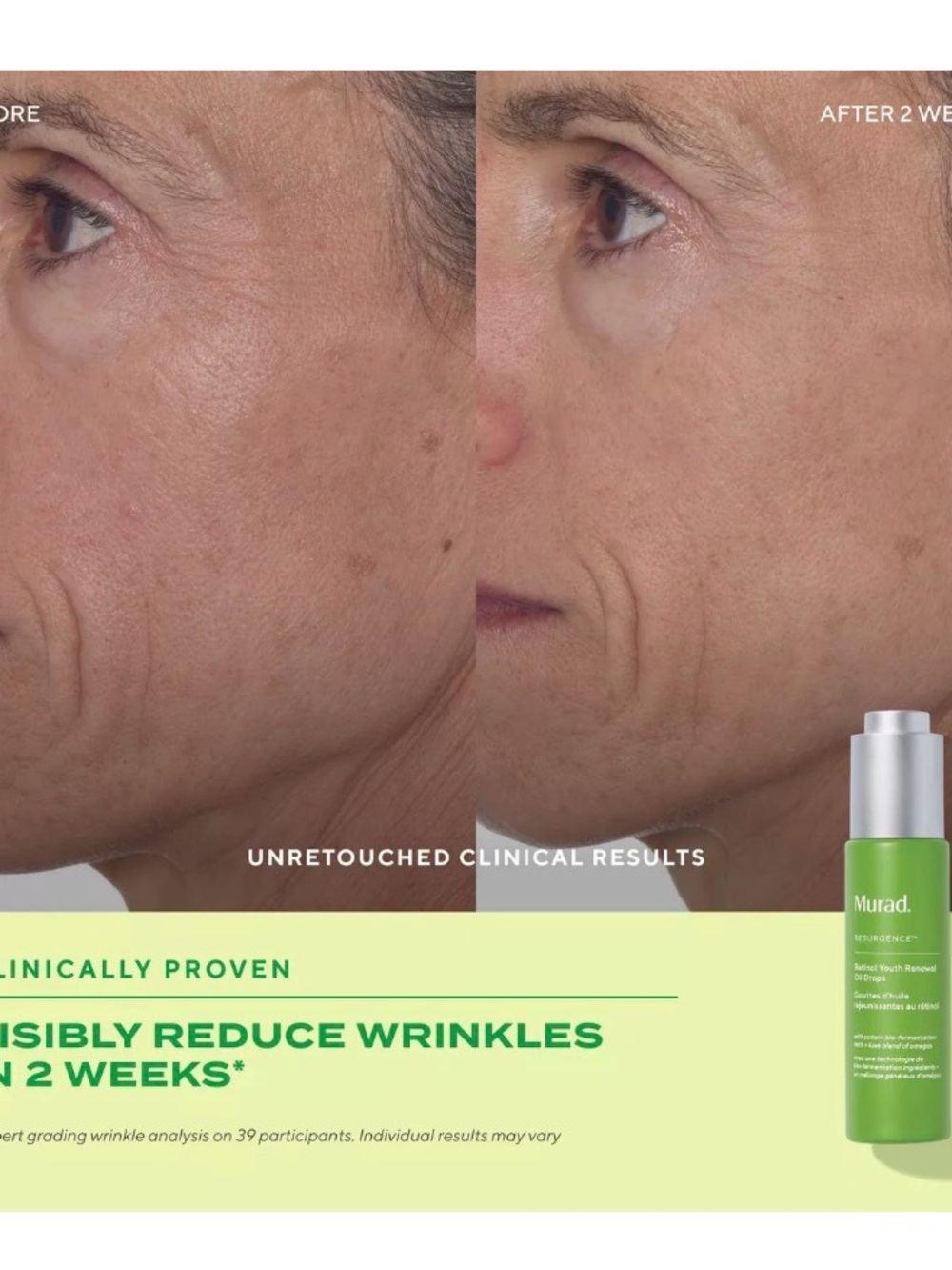 Murad Resurgence Retinol Youth Renewal Oil Drops - Picture 5 of 6